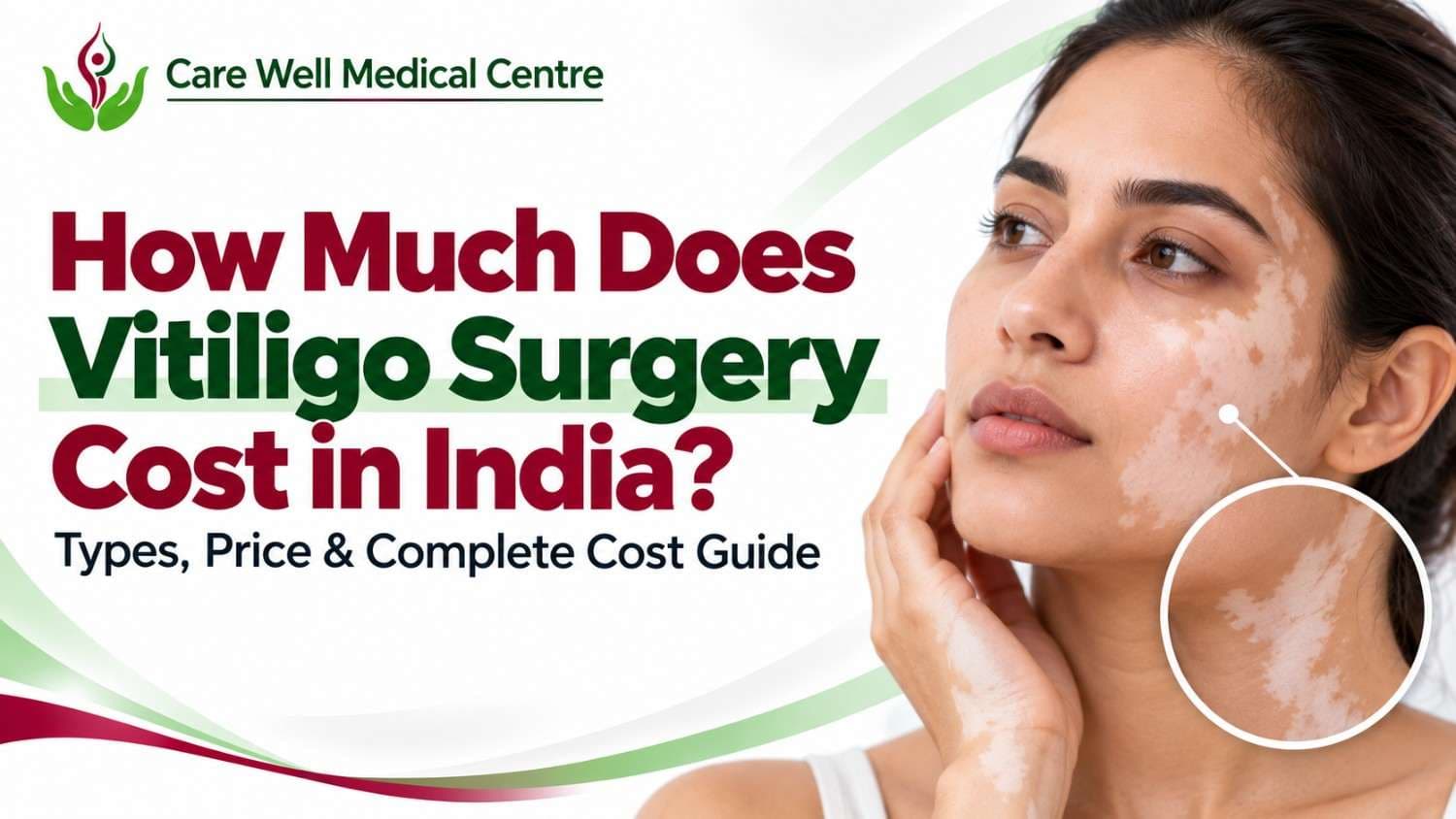 How Much Does Vitiligo Surgery Cost in India
