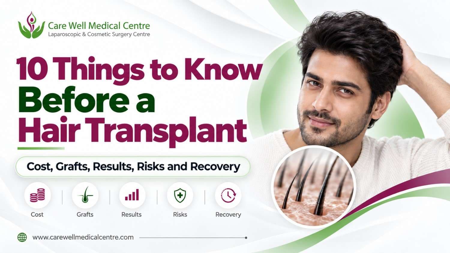 10 Things to Know Before a Hair Transplant