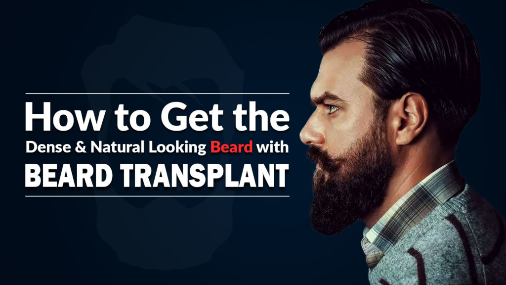 beard-transplant-1024x576.jpg