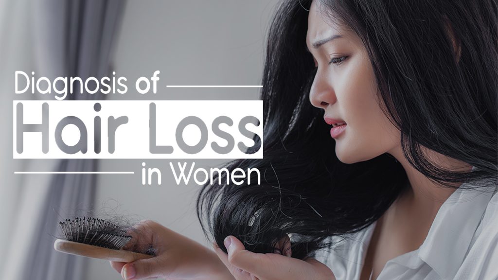 Diagnosis-of-Hair-Loss-in-Women-1-1024x576.jpg