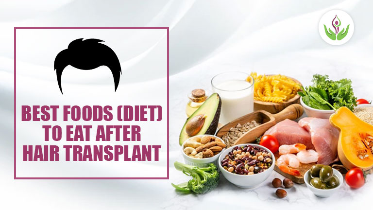 Best Foods (Diet) To Eat After Hair Transplant | Care Well Medical Centre