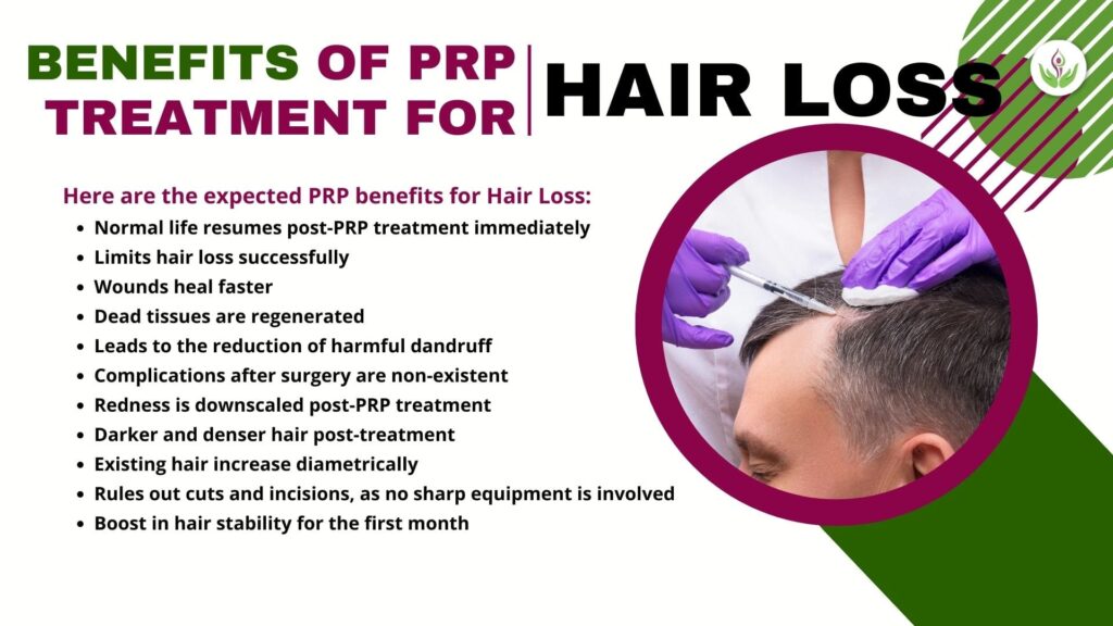 Benefits of PRP Treatment For Hair Loss