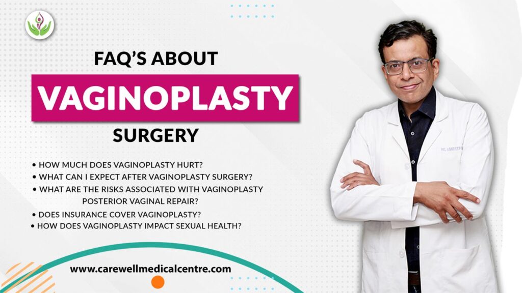 FAQ's About Vaginoplasty Surgery, frequently asked question about vaginoplasty surgery, vagina surgery cost in delhi, vaginoplasty treatment cost, vaginoplasty surgery