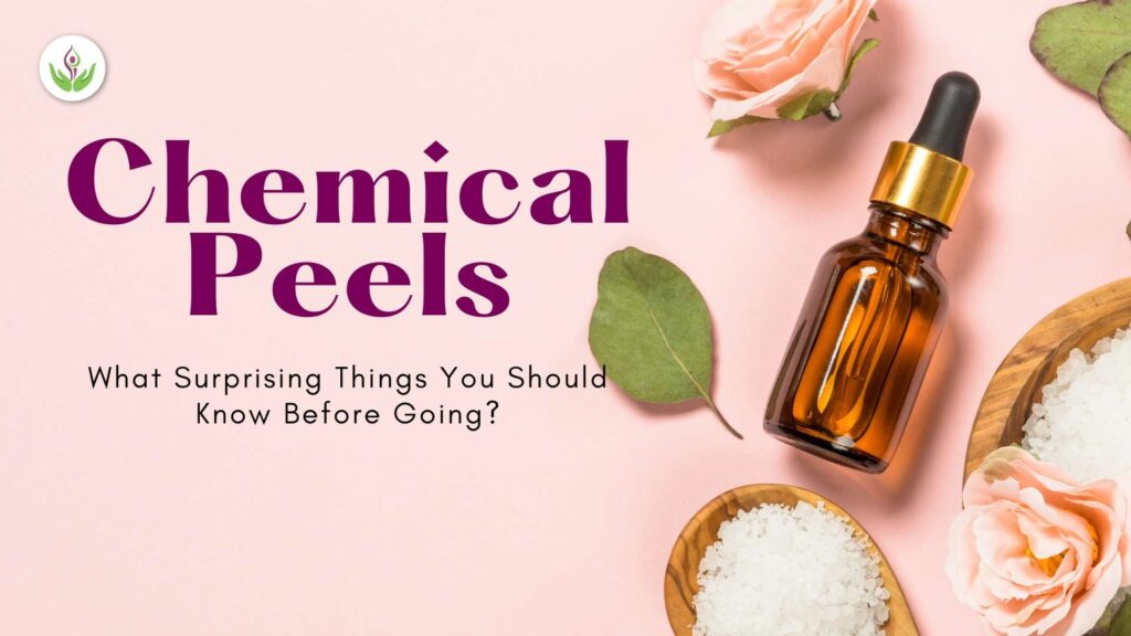 Chemical-Peels-1024x576.jpg