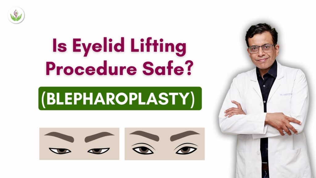 Is-Eyelid-Lifting-Blepharoplasty-Procedure-Safe-min-1024x576.jpg