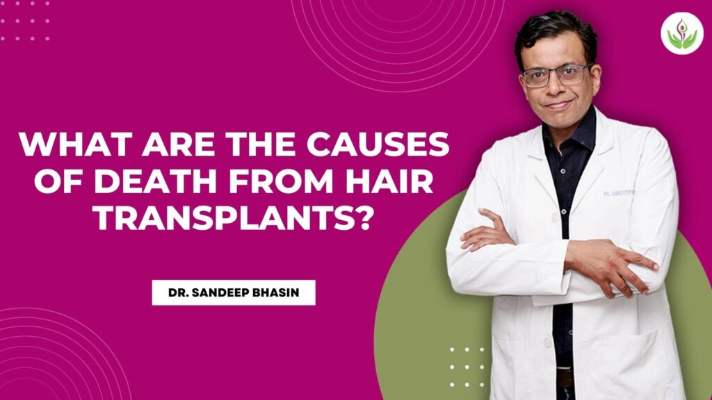 What-are-the-causes-of-death-from-hair-transplants-min-1024x576.jpg