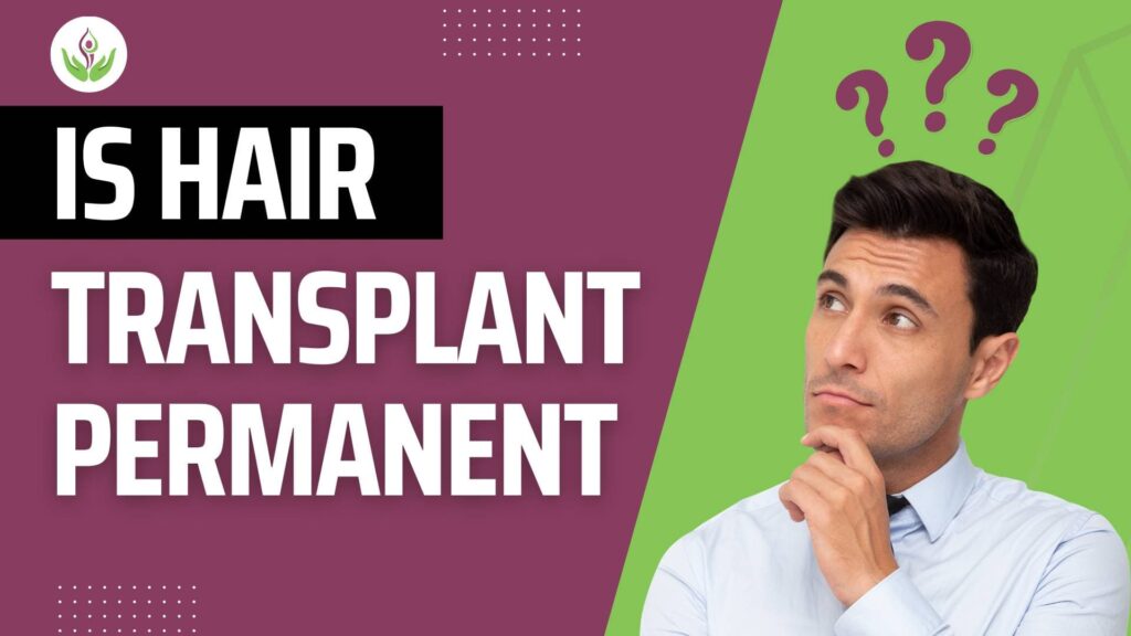 Is-Hair-Transplant-Permanent-min-1024x576.jpg