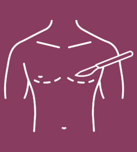 Gynecomastia Treatment