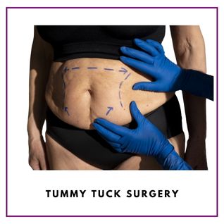 Tummy Tuck Surgery in Delhi