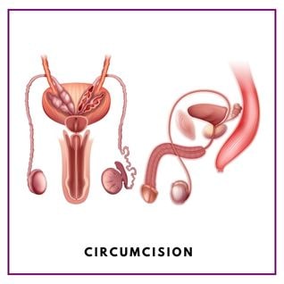 circumcision treatment in delhi