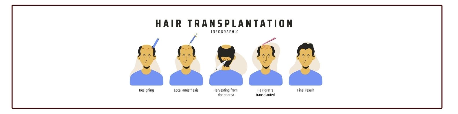 Hair Transplant Techniques in Delhi: Advanced Methods for Natural Results