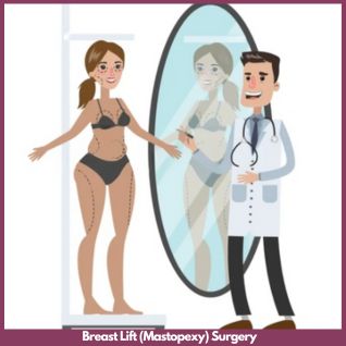 Breast Lift (Mastopexy) surgery