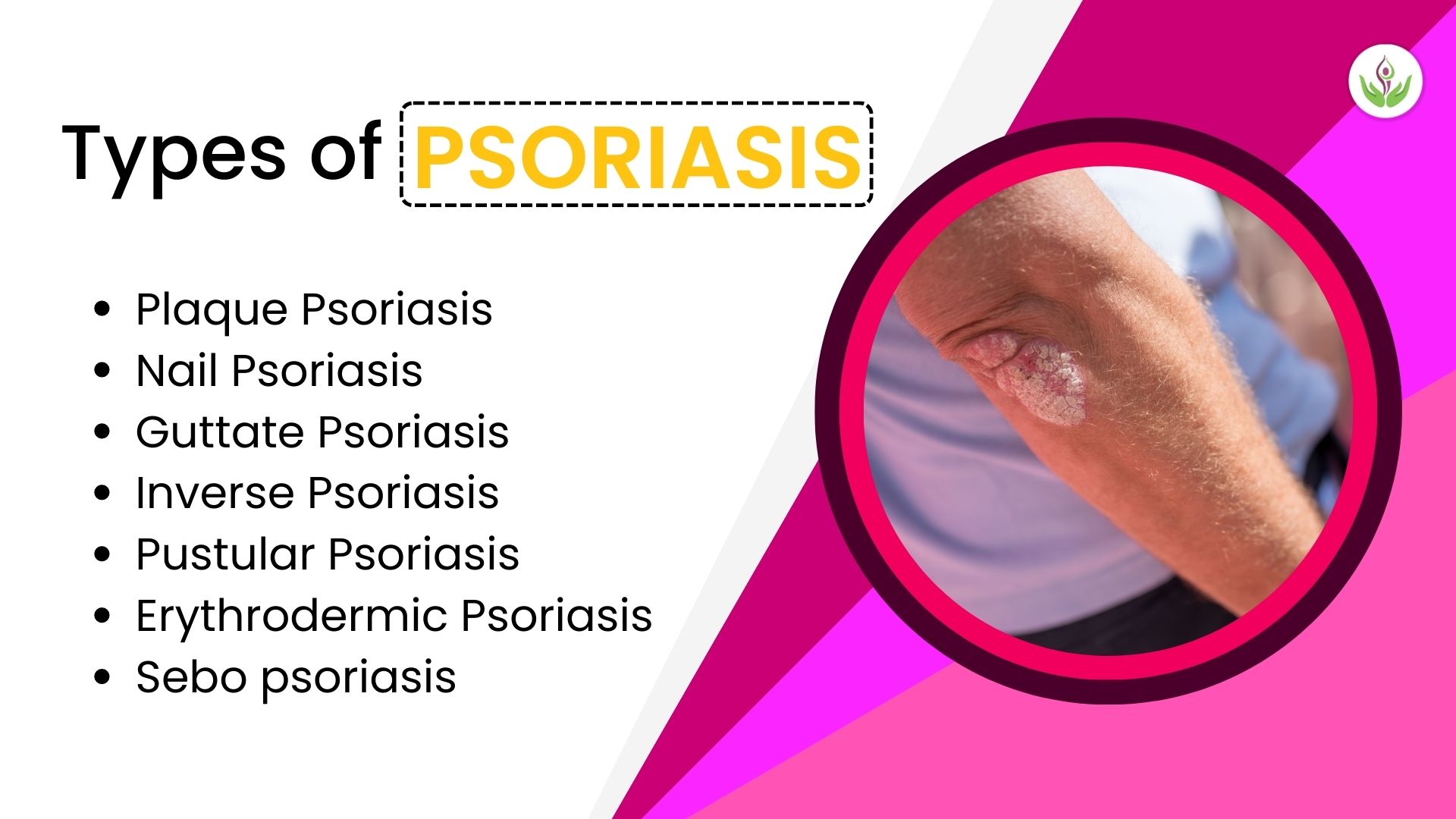 Types of psorasis