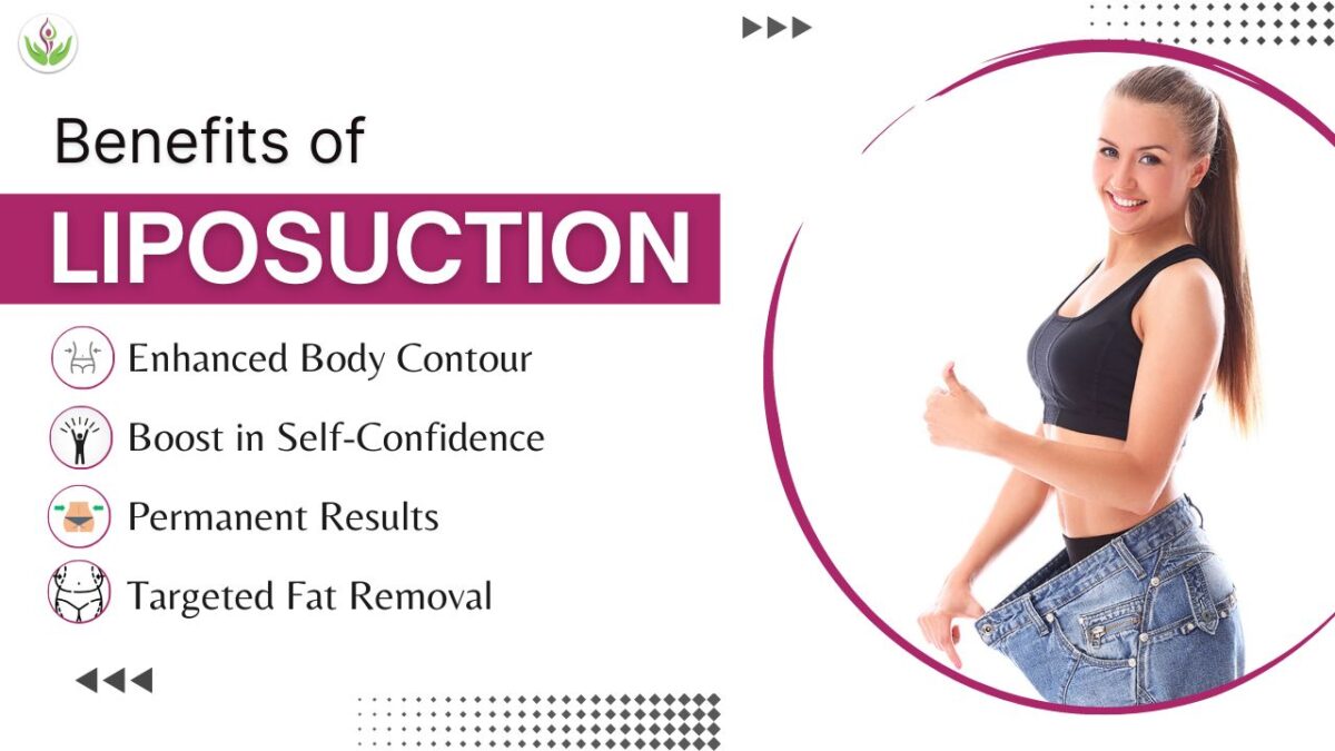 Benefits of Liposuction