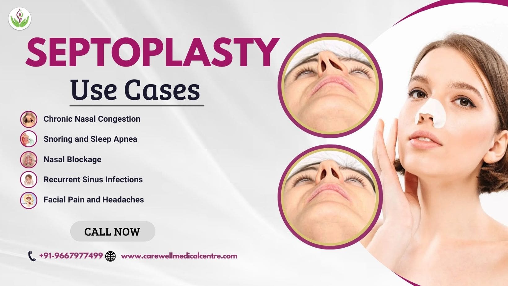 Septoplasty Use Cases