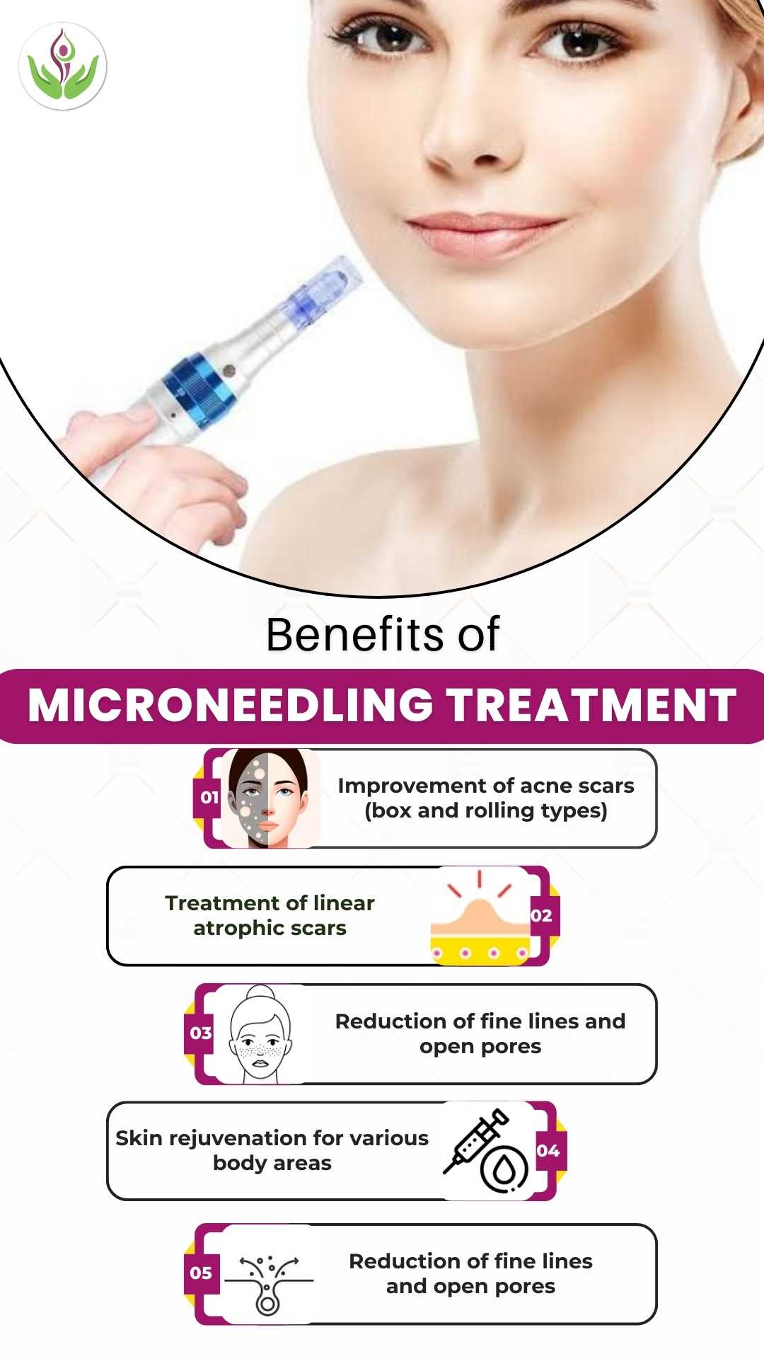 Benefits of Microneedling Treatment