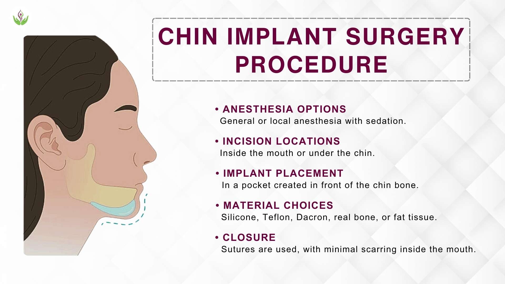 Chin Implant Surgery Procedure