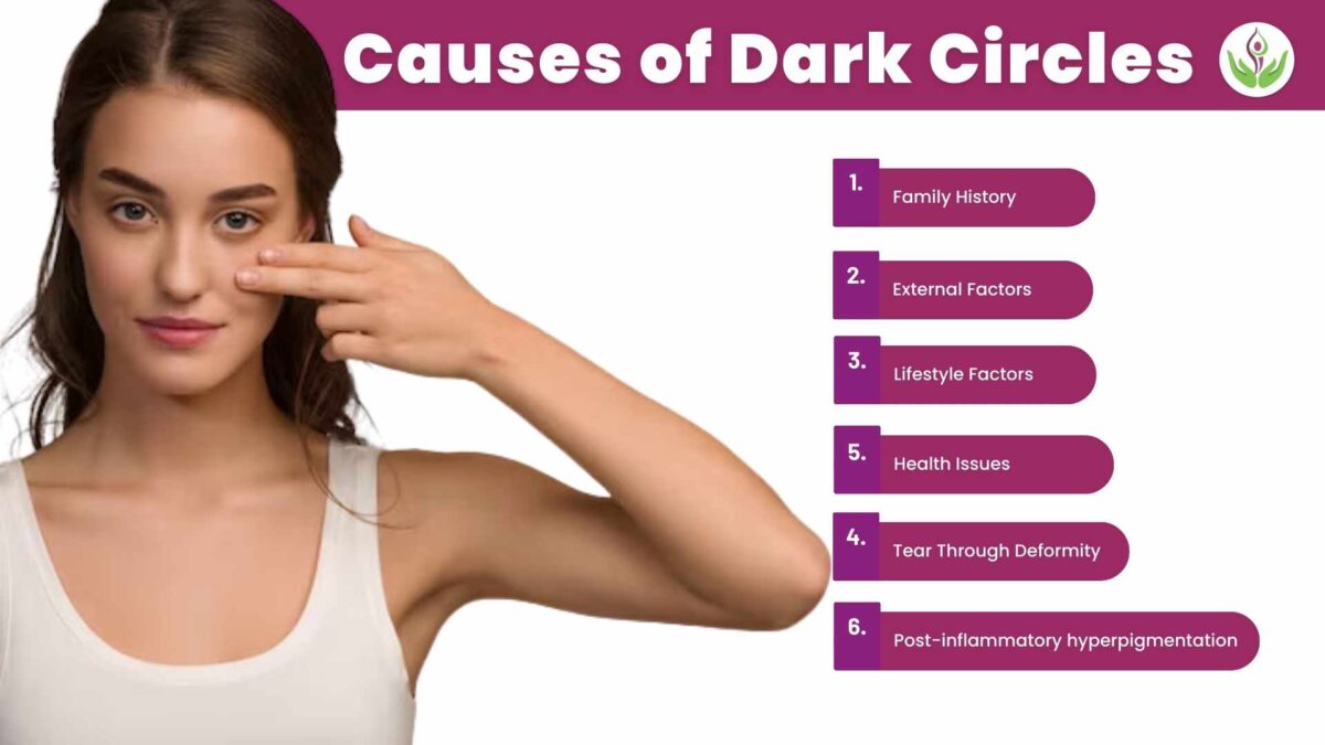 causes of dark circles