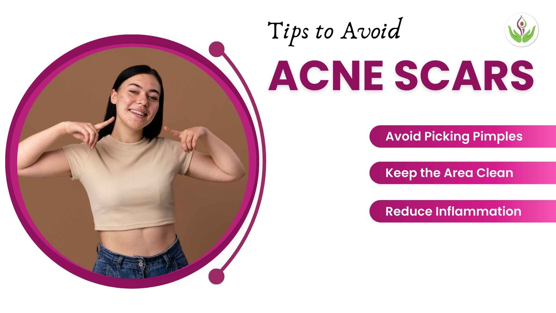 Tips to Avoid Acne Scars and Acne Scar Treatment in Delhi