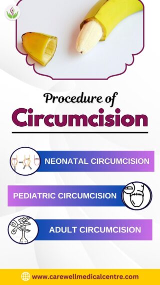 Procedure of Circumcision