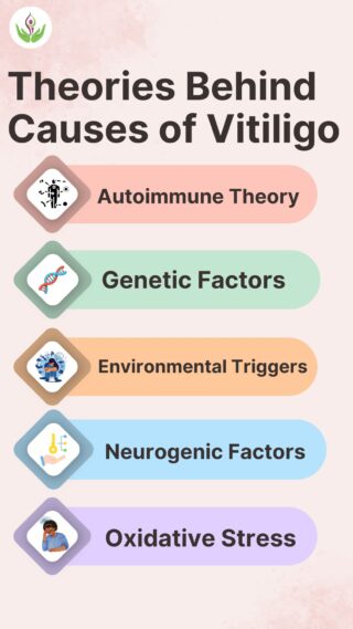 Theories Behind the Causes of Vitiligo