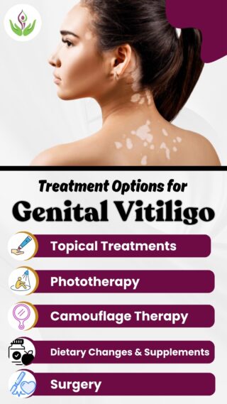 Treatment Options for Genital Vitiligo