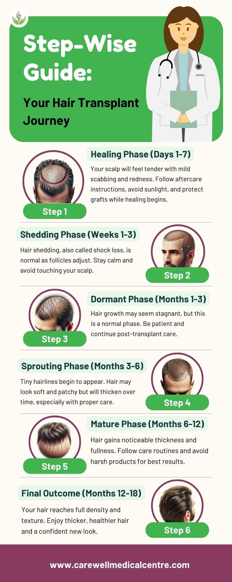 Hair Transplant Journey: Step-Wise Guide