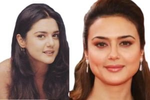 Preity Zinta Before and After photo