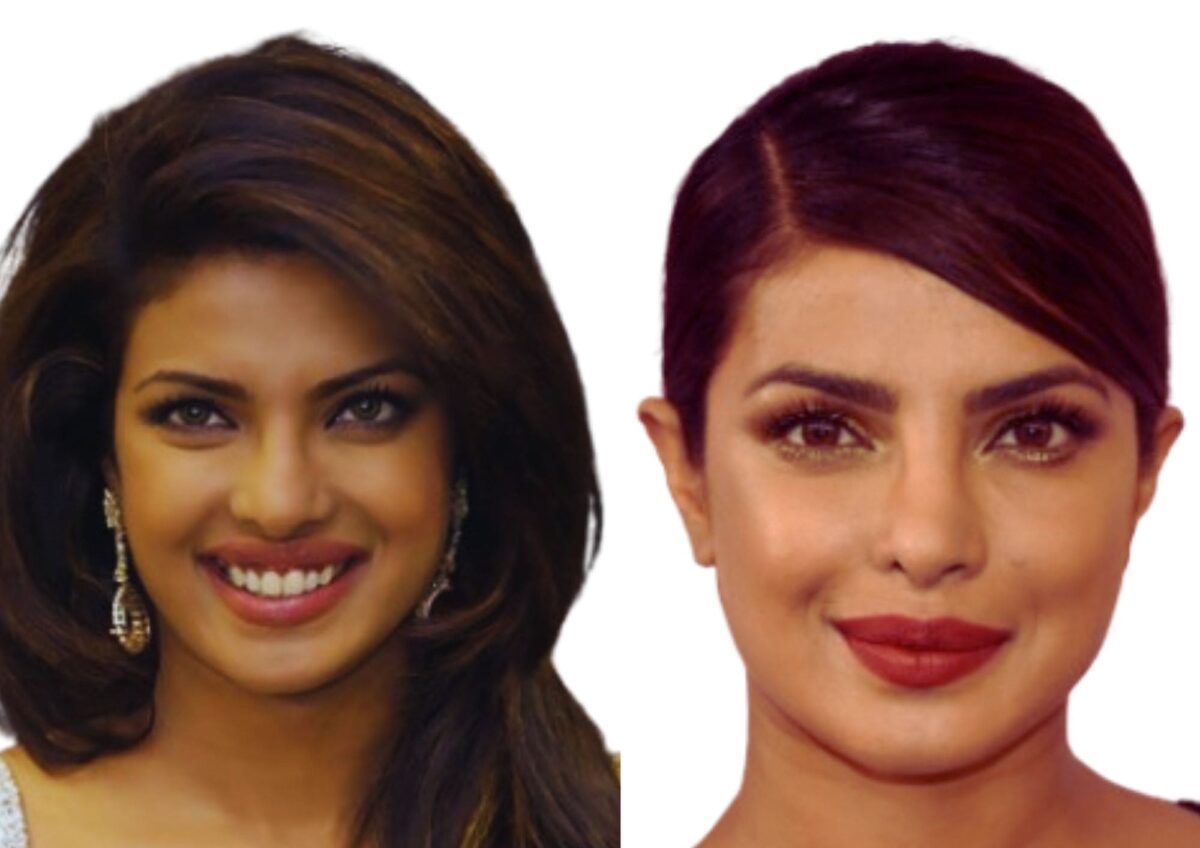 Priyanka Chopra's before and after transformation reflecting Bollywood celebrities and plastic surgery.