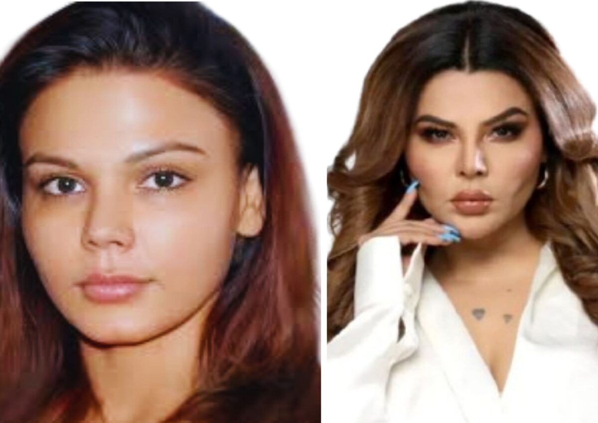 Rakhi Sawant's before and after transformation highlighting Bollywood celebrities and plastic surgery.