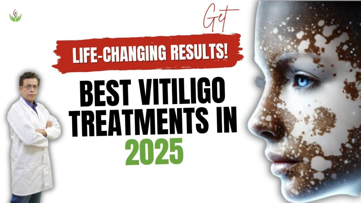 Best-Vitiligo-Treatments-min-1200x675.jpg