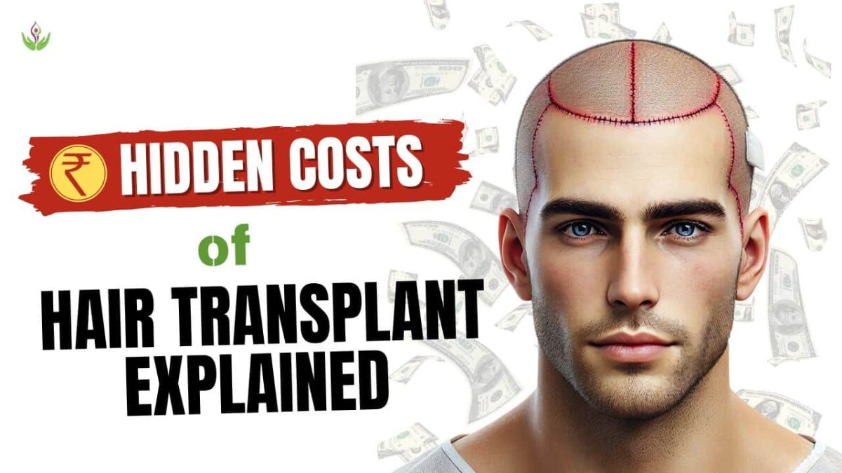 hidden-cost-of-hair-transplant-min-1200x675.jpg